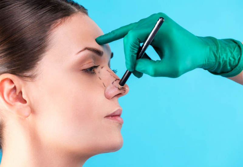 Rhinoplasty in Iran